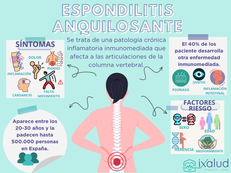 Dolor Lumbar Espondilitis Anquilosante Ixalud Es