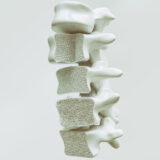 Osteoporosis, la enfermedad silenciosa