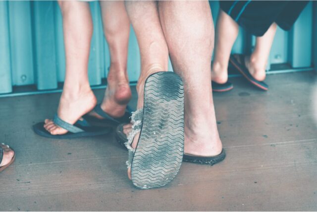 ¿Por qué empeora la fascitis plantar en verano?