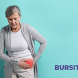 BURSITIS